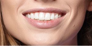 Dentist in Ashburn Virginia dental Crowns and Bridges