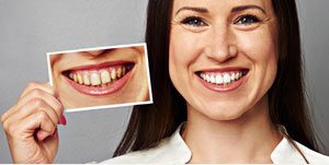 Dentist in Ashburn Virginia Periodontal